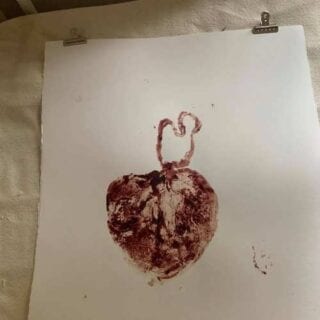 La foto della placenta a forma di cuore