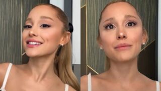 ariana grande filler botox